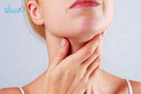 U tuyến giáp khi nào cần phải mổ?