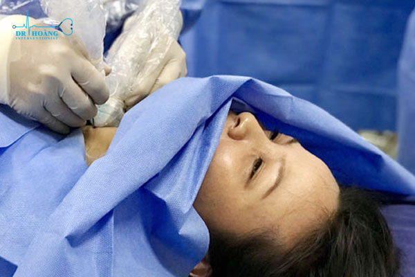 điều trị u tuyến giáp lành tính không cần phẫu thuật bằng đốt sóng cao tần U tuyến giáp khi nào cần phải mổ?