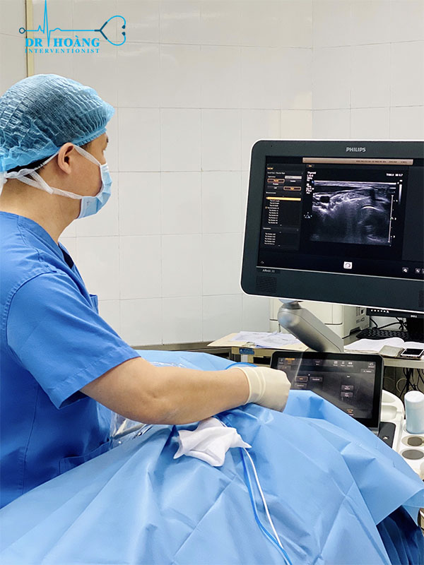 Đốt sóng cao tần - Bước đột phá thẩm mỹ trong điều trị u tuyến giáp