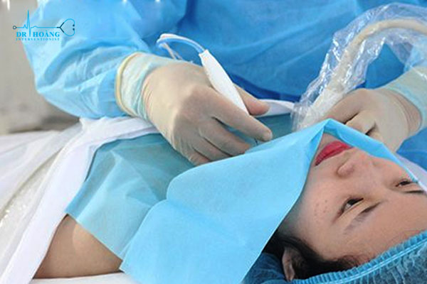 Đốt sóng cao tần u tuyến giáp: Thông tin cần nắm rõ