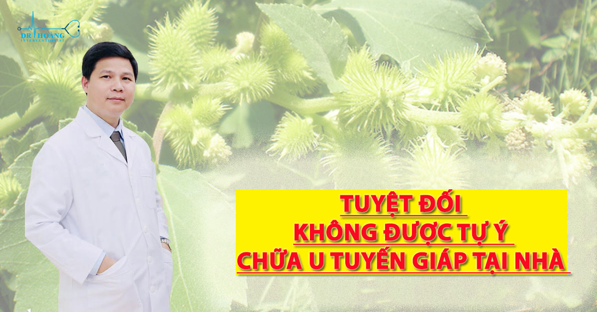 Chữa u tuyến giáp tại nhà có được không?