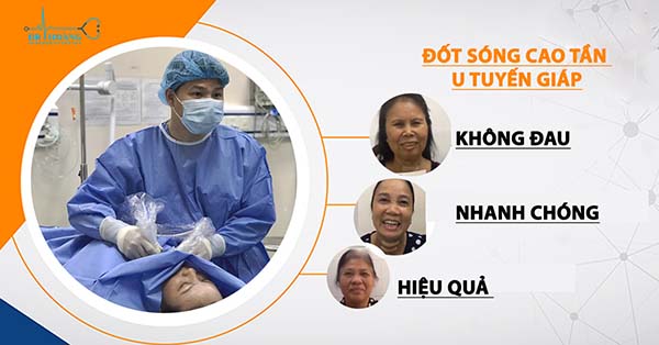 Điều trị u tuyến giáp bằng sóng cao tần mất bao lâu?