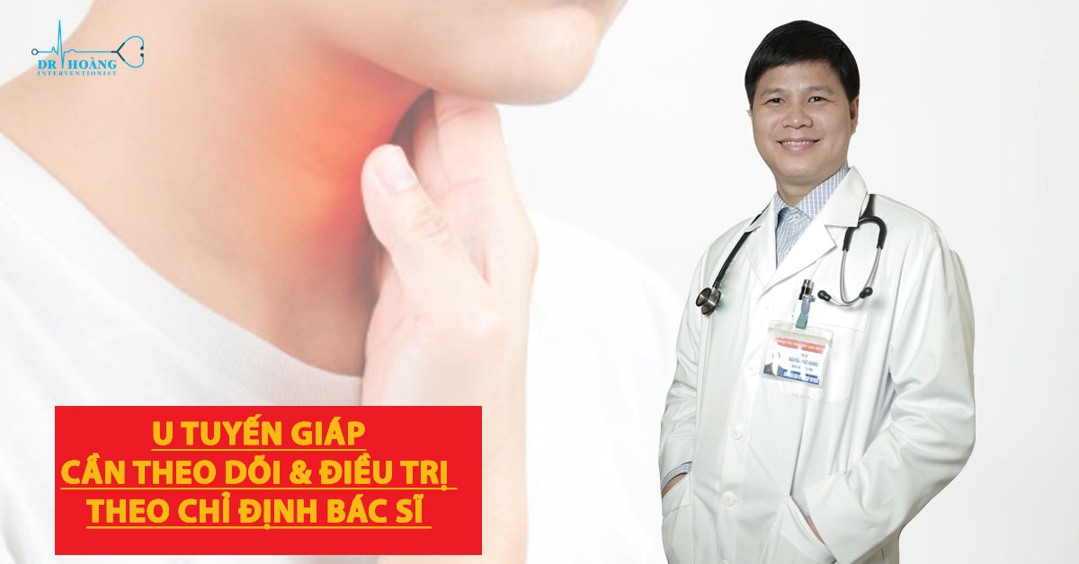 U tuyến giáp tự hết không?