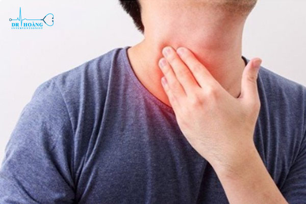 Viêm tuyến giáp và những điều cần biết