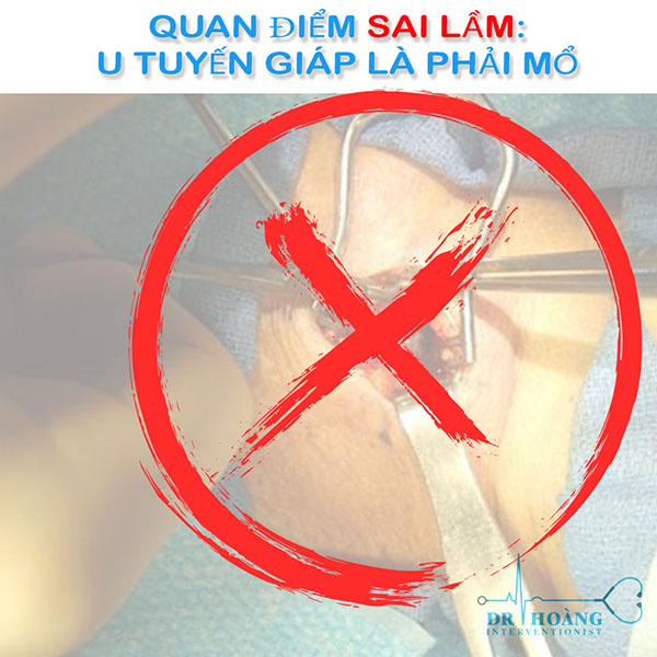 Điều trị nhân tuyến giáp dứt điểm, an toàn