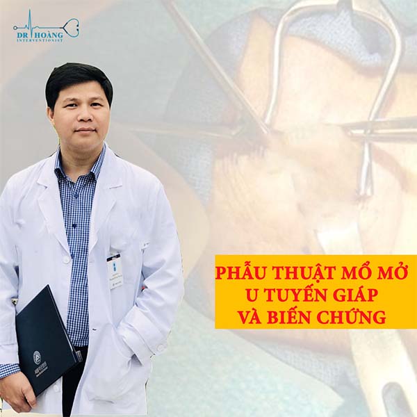 phương pháp điều trị RFA u tuyến giáp lành tính 