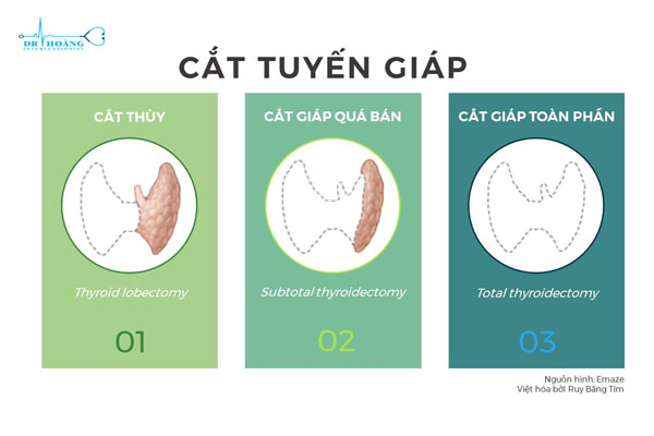 Các yếu tố nguy cơ gây bệnh suy giáp