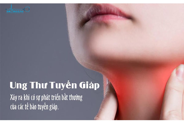 Yếu tố nguy cơ gây ung thư tuyến giáp
