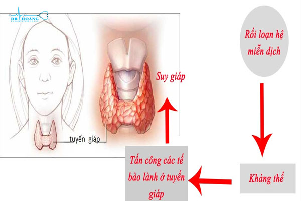 Biến chứng suy giáp và những thông tin cần biết - DR.HOÀNG - PHÒNG ...