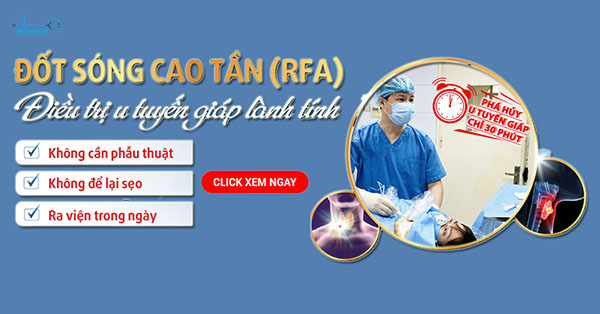 Điều trị u tuyến giáp không sẹo bằng đốt sóng cao tần RFA